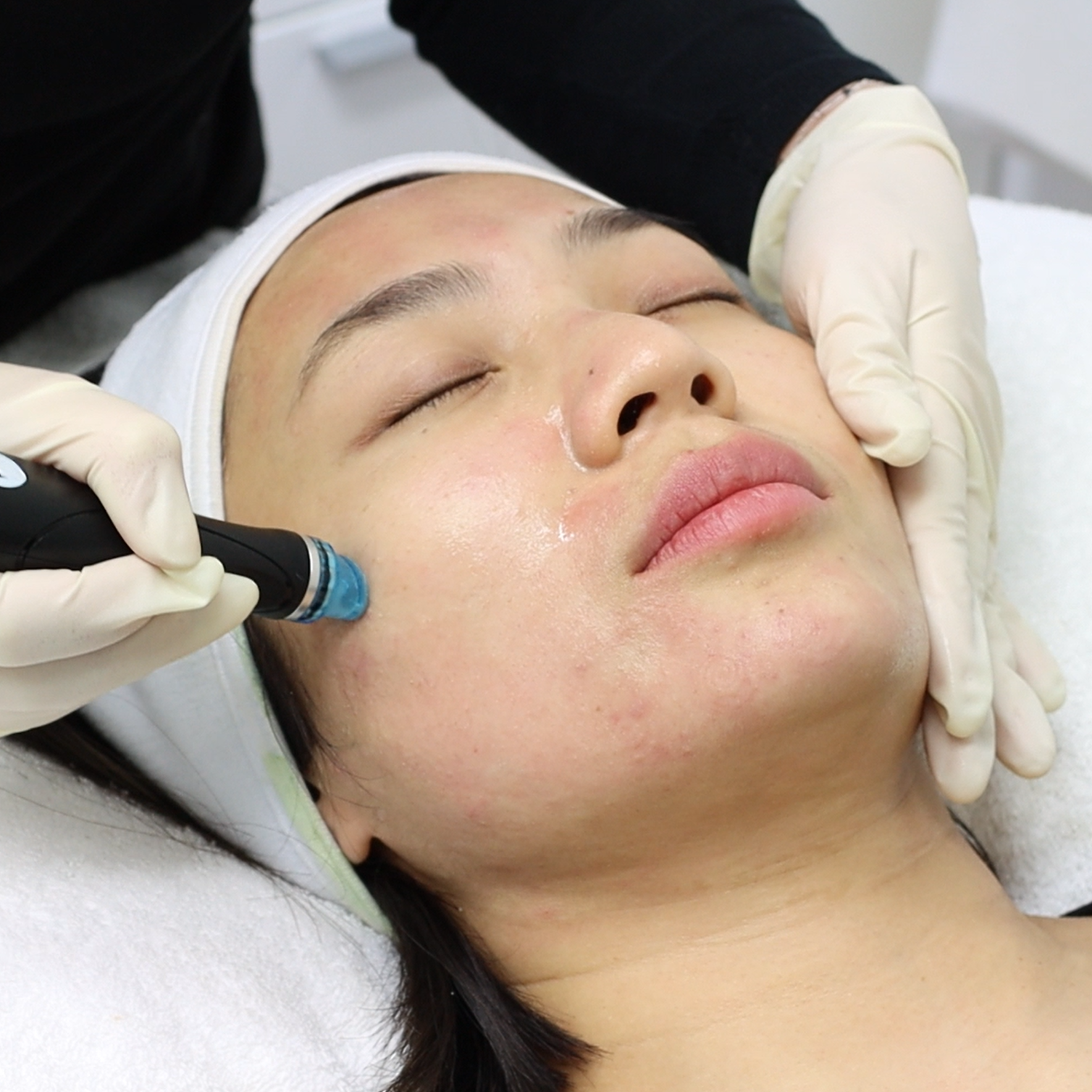 Wollongong’s Top 5 Favourite Facials
