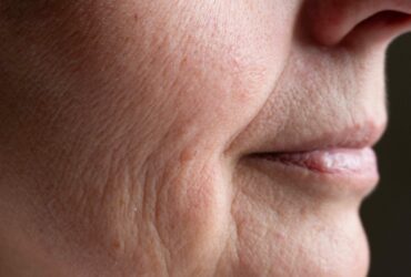 Let’s Make Dehydrated Skin a Thing of the Past