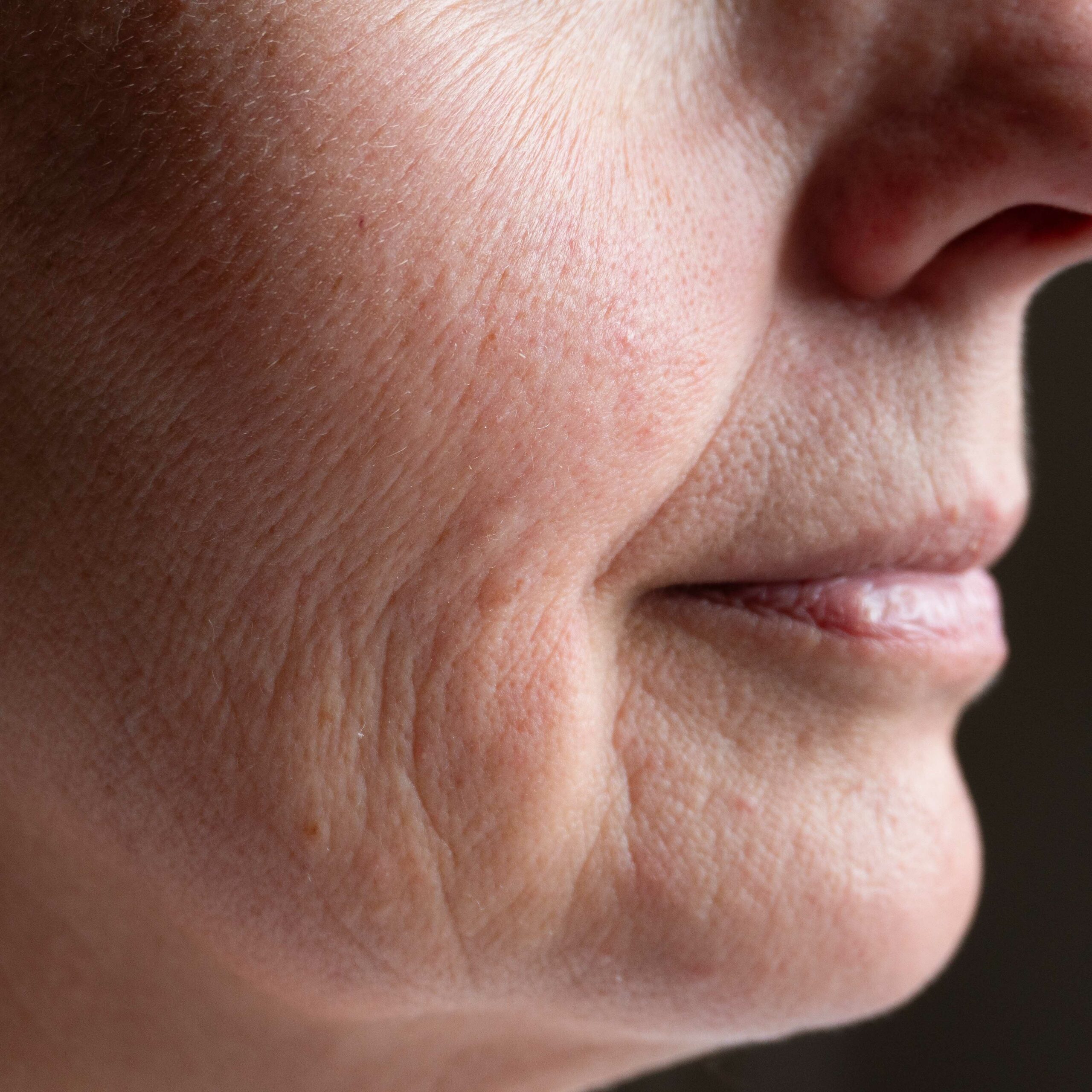 Let’s Make Dehydrated Skin a Thing of the Past