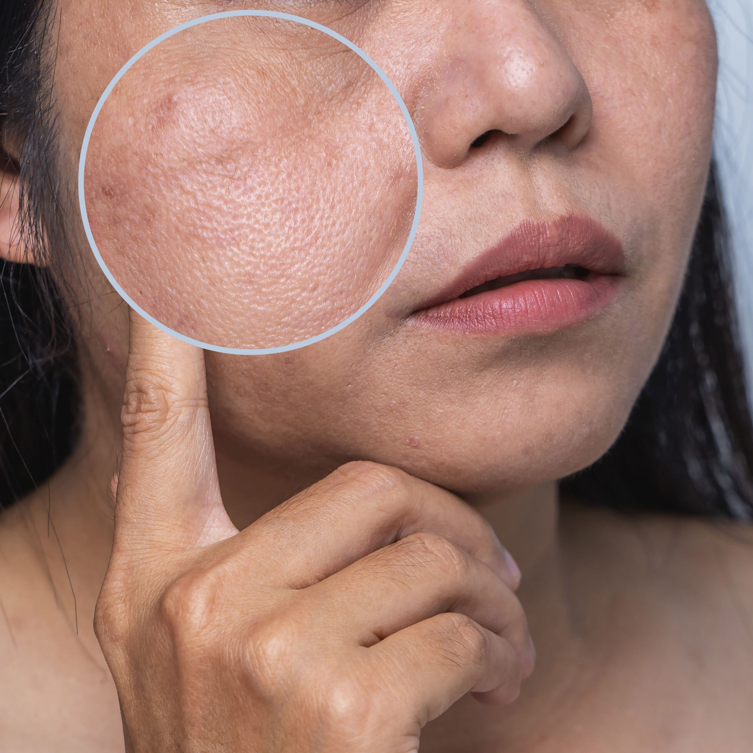 Why Your Skin Looks Dull (and How to Get Your Glow Back)