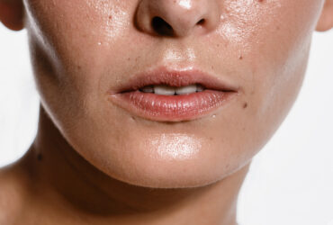 What Causes Oily Skin—and How to Actually Control It