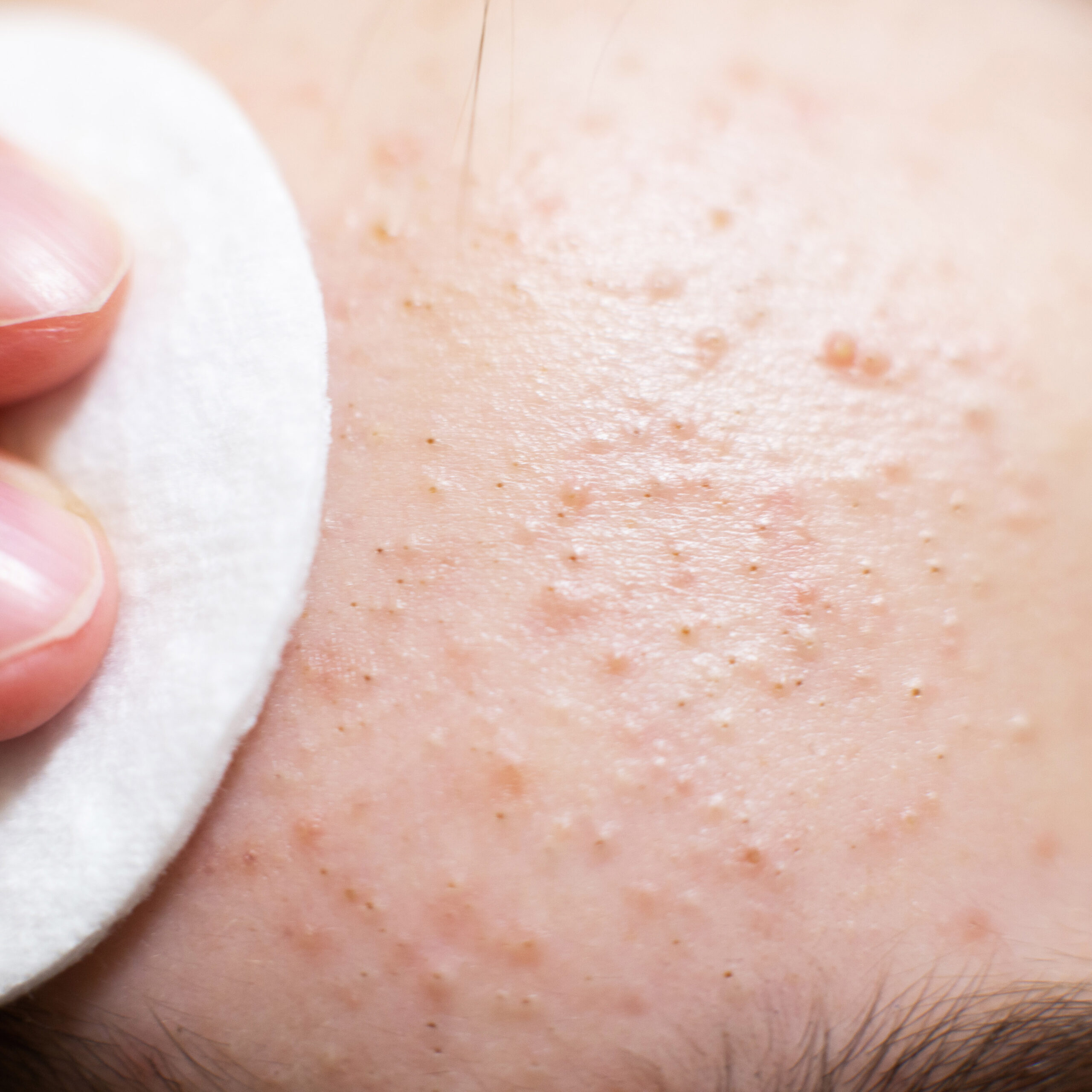 Breakouts Begin Beneath the Surface