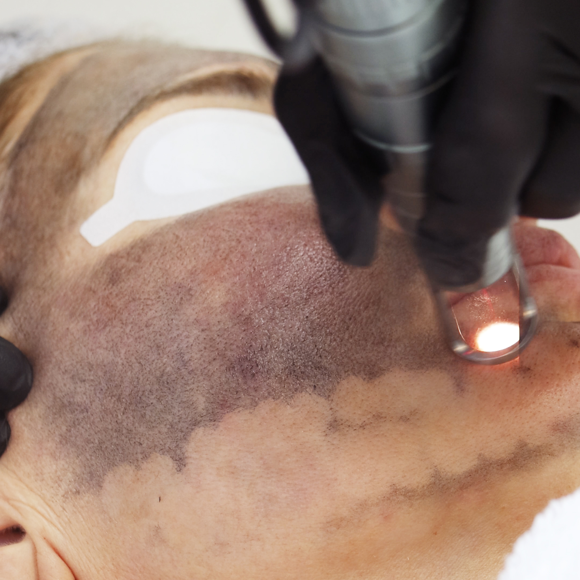 Give Your Skin That Wollongong Coastal Glow